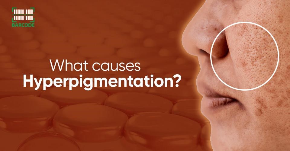 What Causes Hyperpigmentation? 6 UNDERLYING Factors